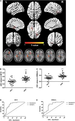 Abnormal Voxel-Based Degree Centrality in Patients With Postpartum Depression: A Resting-State Functional Magnetic Resonance Imaging Study